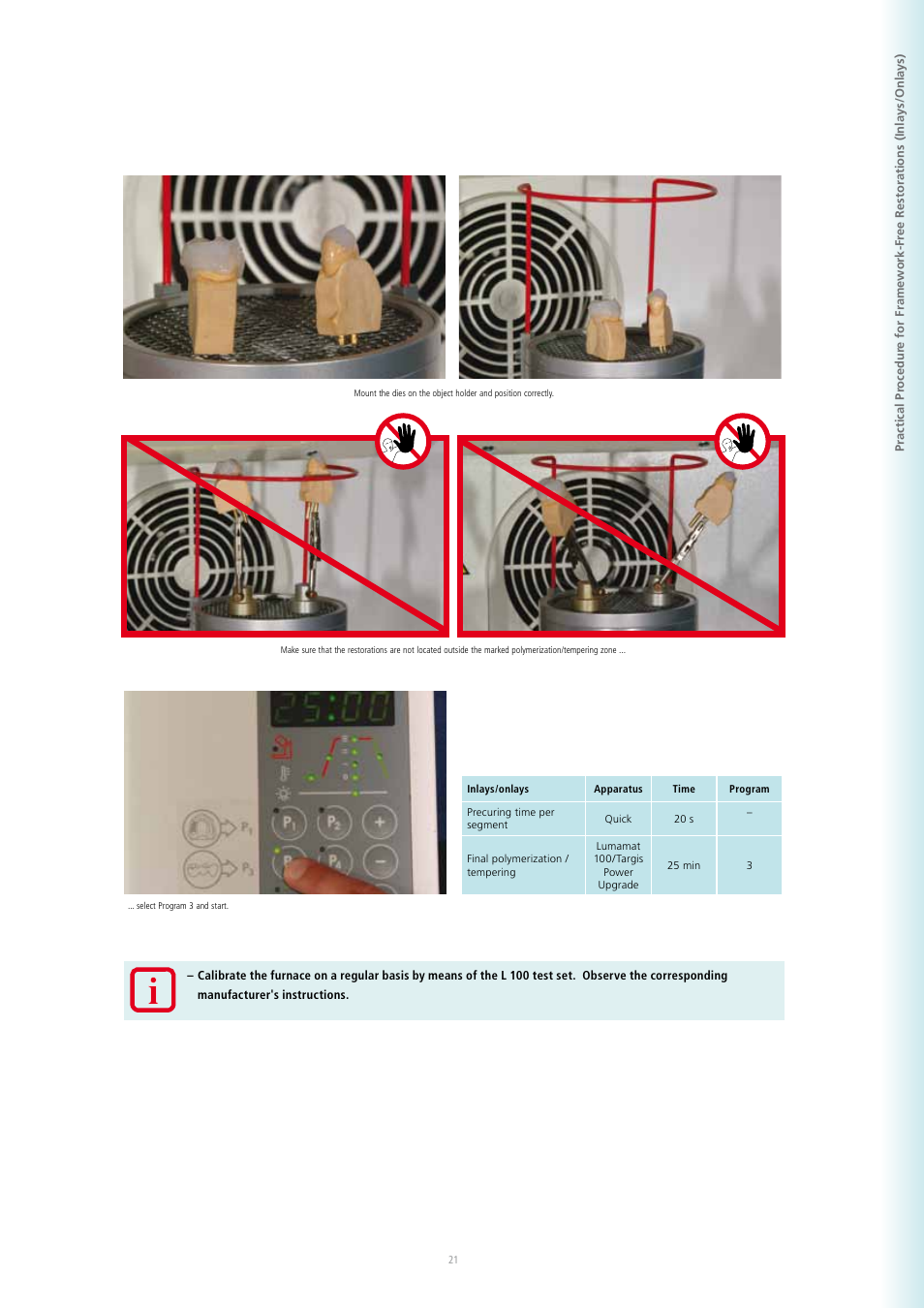 Ivoclar Vivadent SR Adoro User Manual | Page 21 / 88