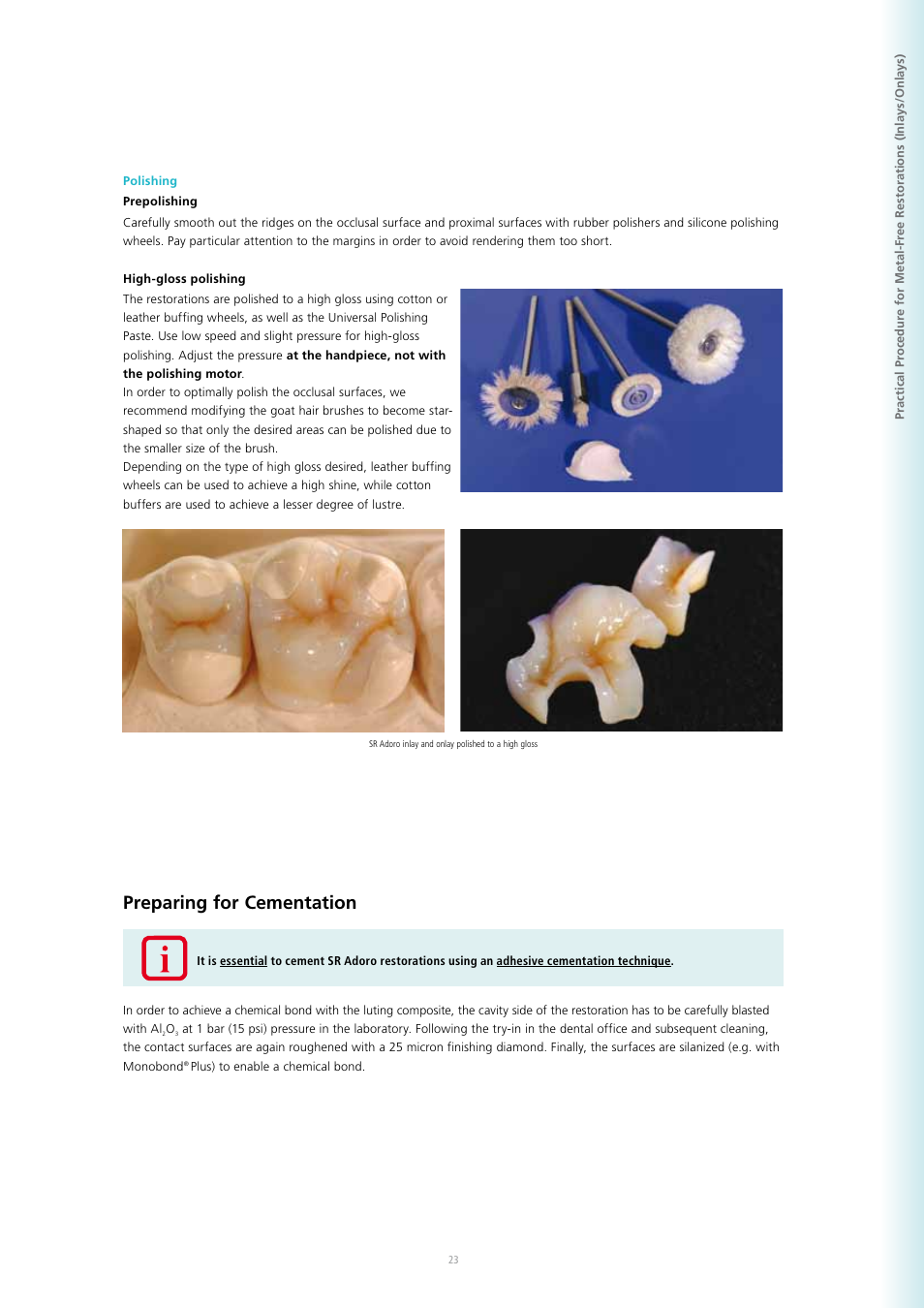 Preparing for cementation | Ivoclar Vivadent SR Adoro User Manual | Page 23 / 88