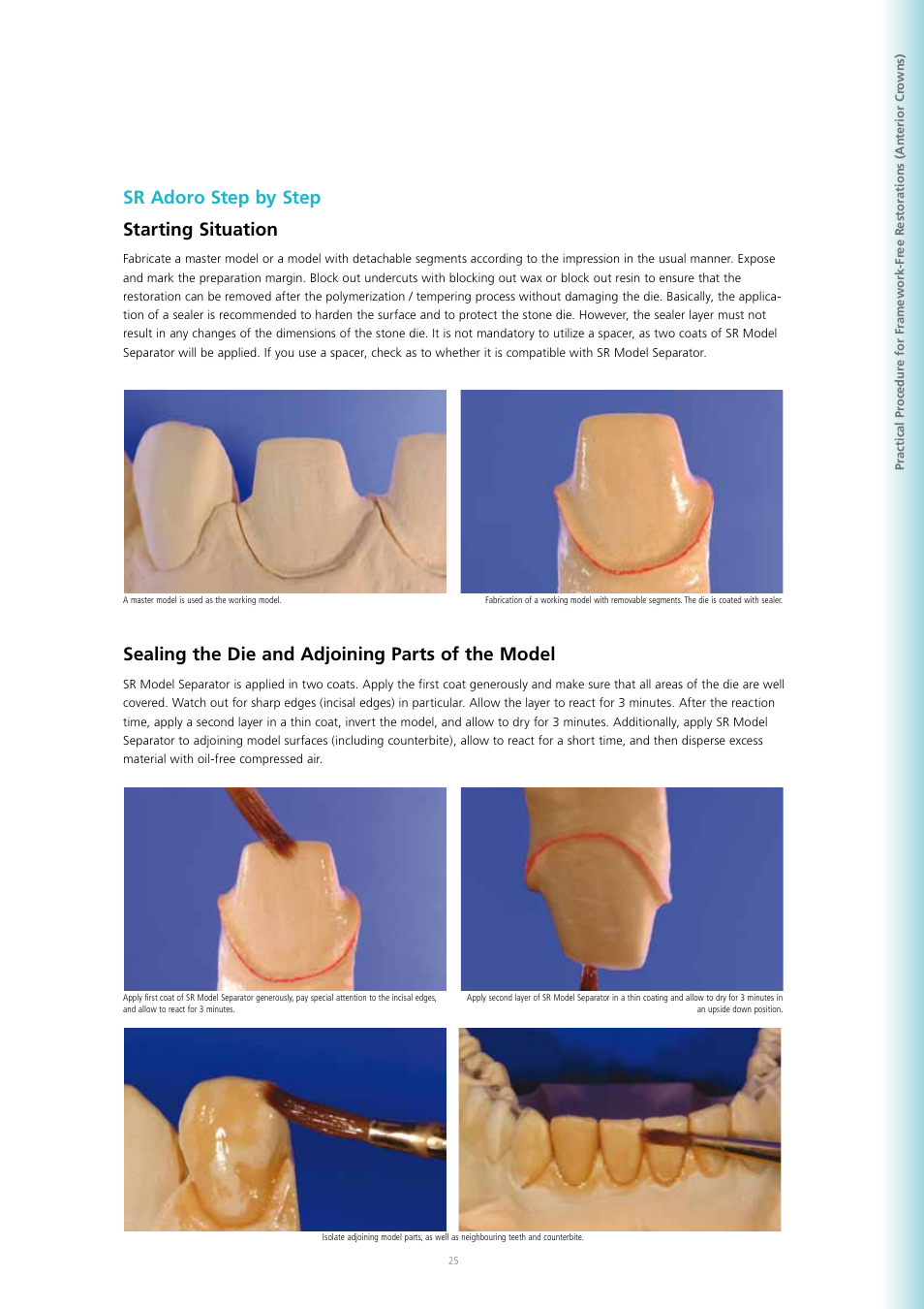 Sr adoro step by step starting situation, Sealing the die and adjoining parts of the model | Ivoclar Vivadent SR Adoro User Manual | Page 25 / 88