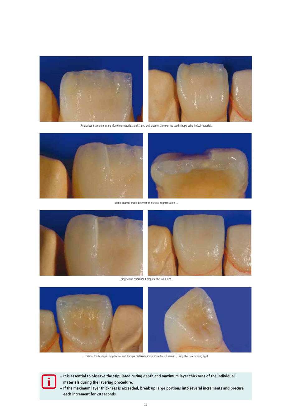 Ivoclar Vivadent SR Adoro User Manual | Page 28 / 88