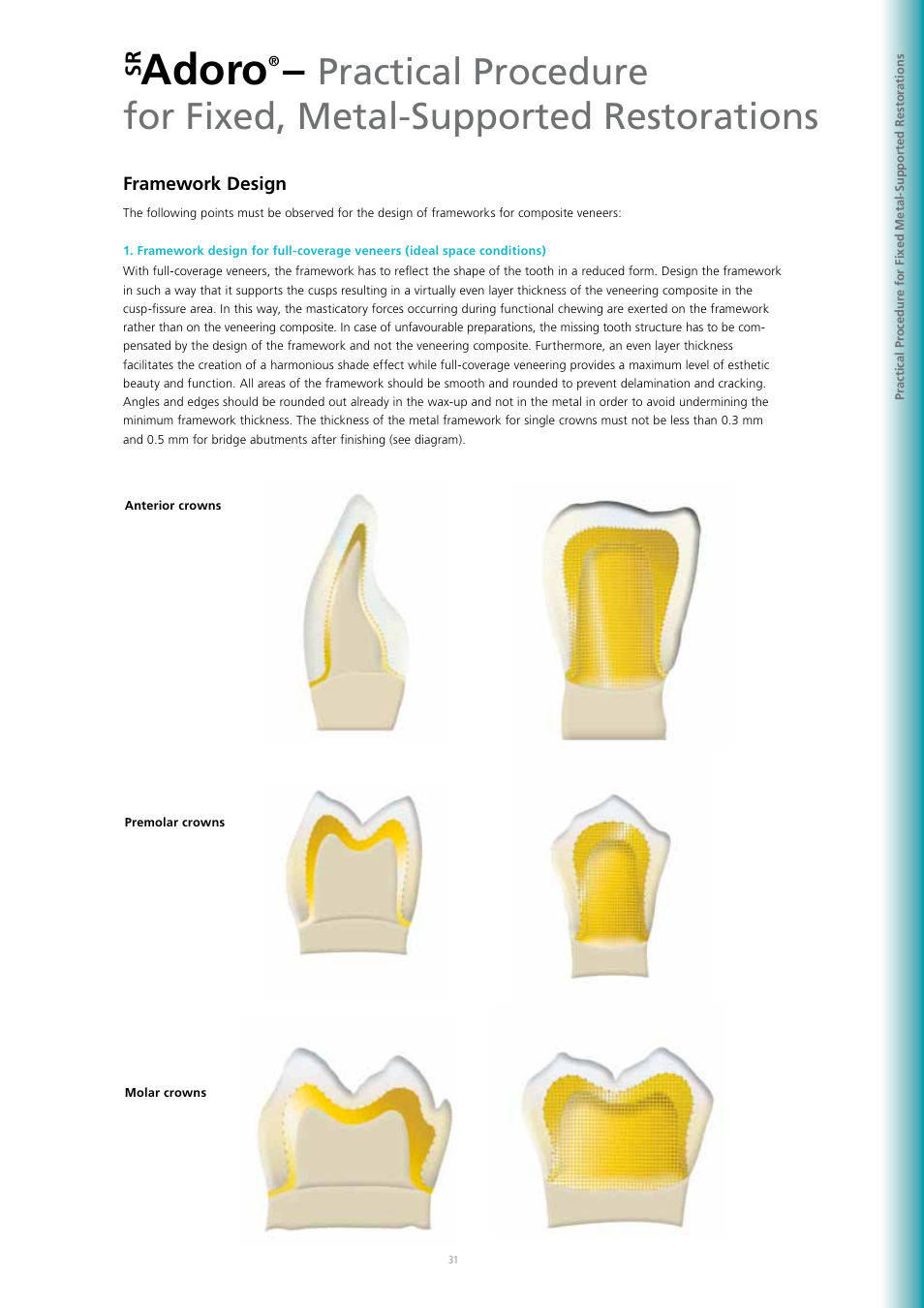 Adoro | Ivoclar Vivadent SR Adoro User Manual | Page 31 / 88