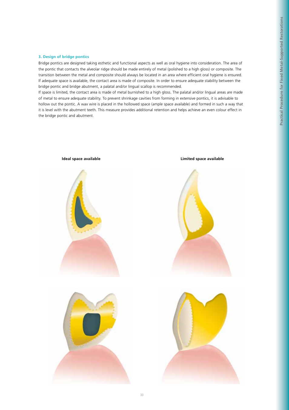 Ivoclar Vivadent SR Adoro User Manual | Page 33 / 88