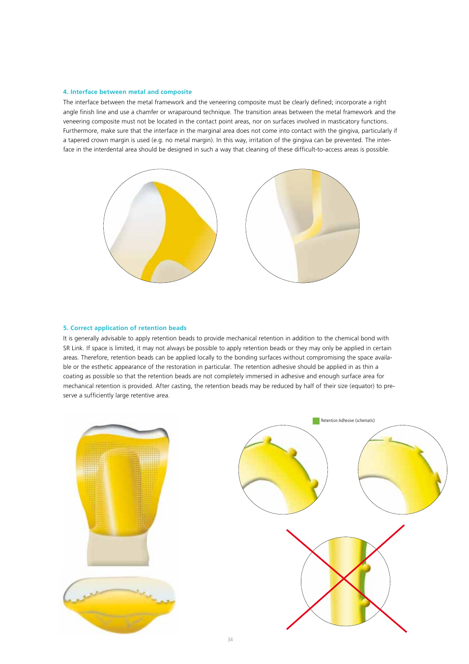 Ivoclar Vivadent SR Adoro User Manual | Page 34 / 88