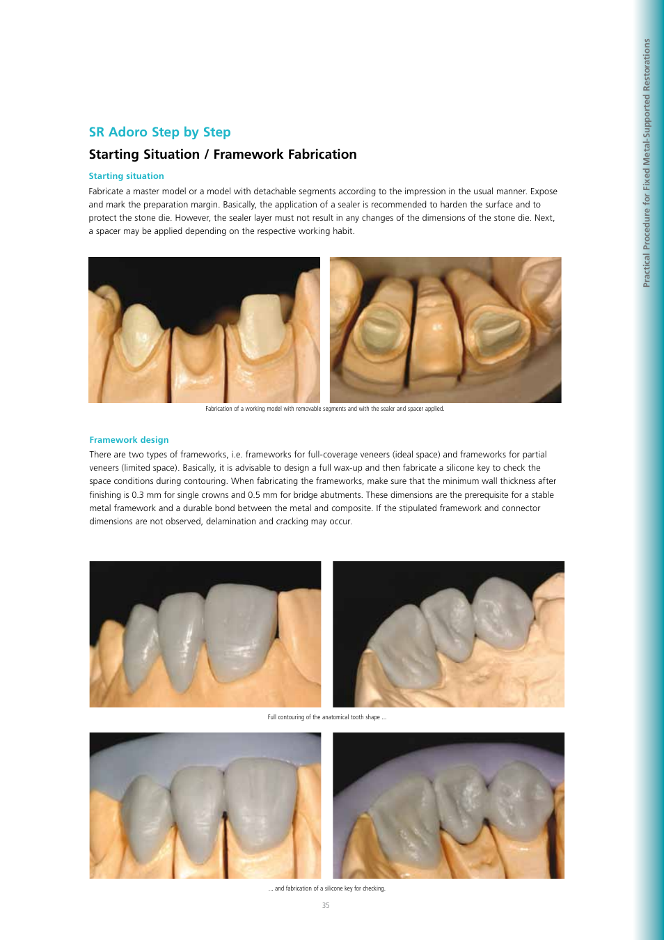 Ivoclar Vivadent SR Adoro User Manual | Page 35 / 88