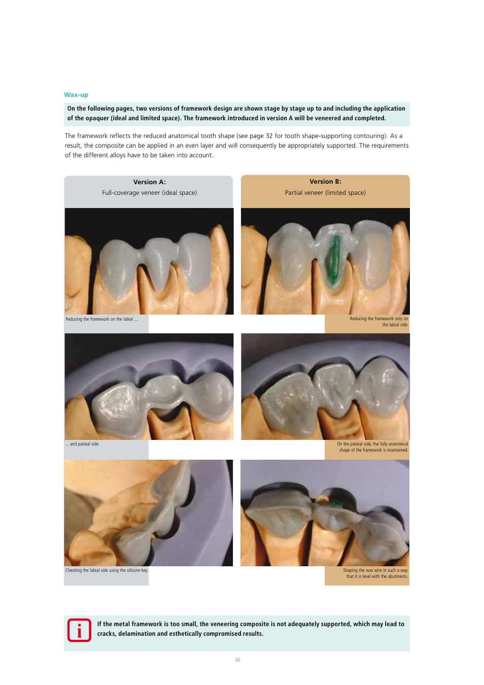 Ivoclar Vivadent SR Adoro User Manual | Page 36 / 88