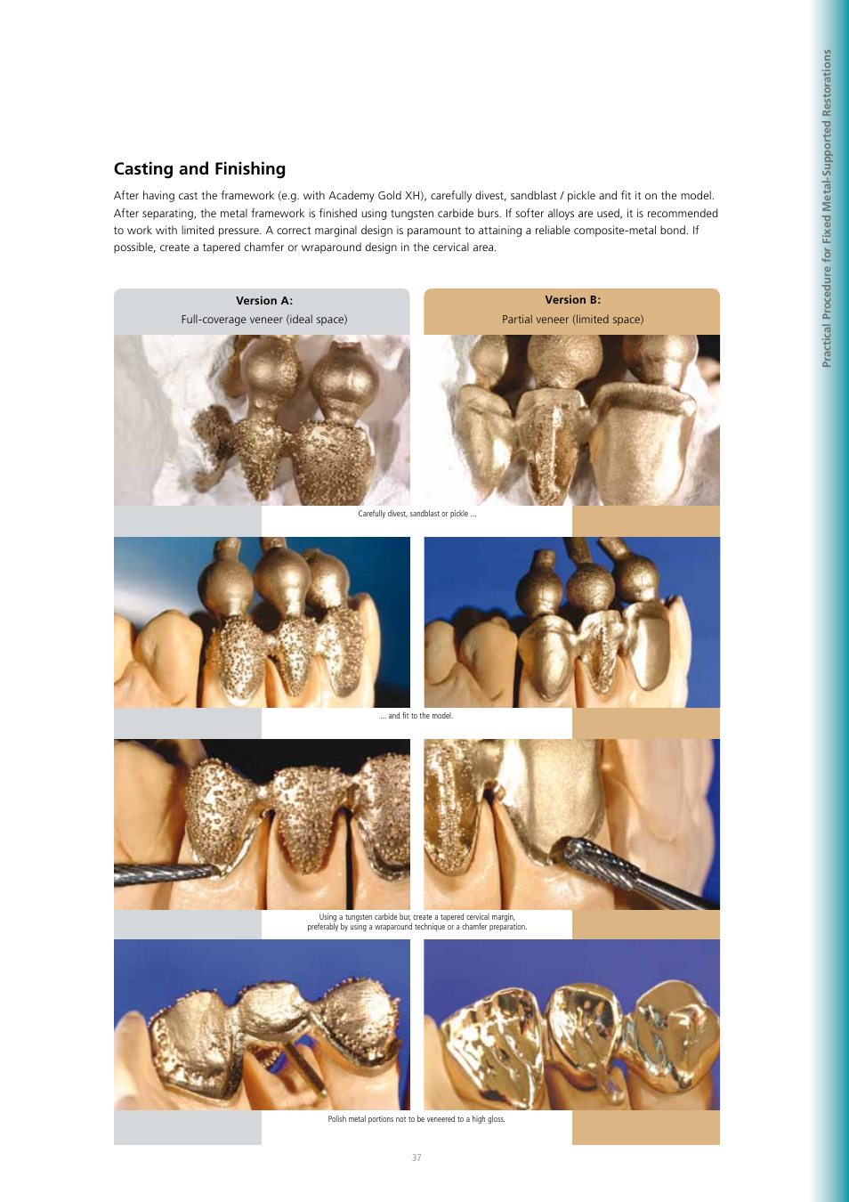 Casting and finishing | Ivoclar Vivadent SR Adoro User Manual | Page 37 / 88