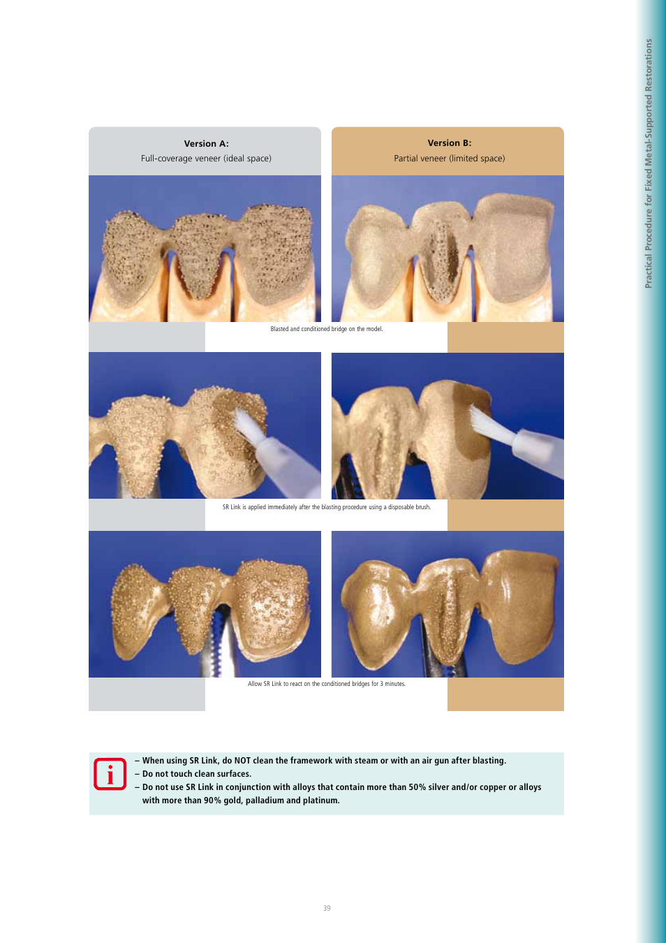 Ivoclar Vivadent SR Adoro User Manual | Page 39 / 88