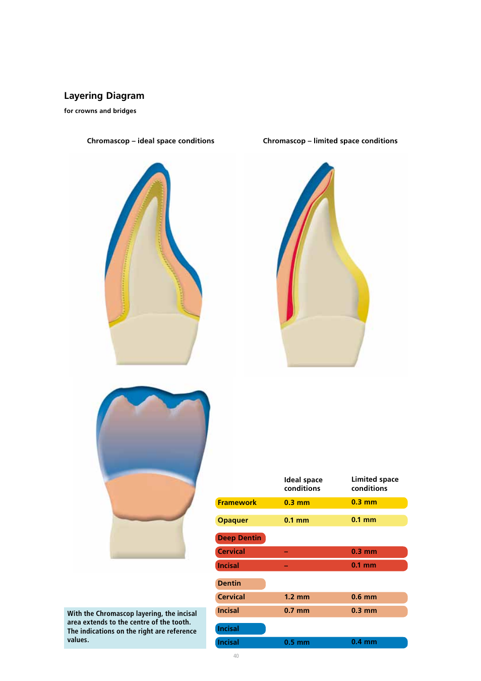 Layering diagram | Ivoclar Vivadent SR Adoro User Manual | Page 40 / 88