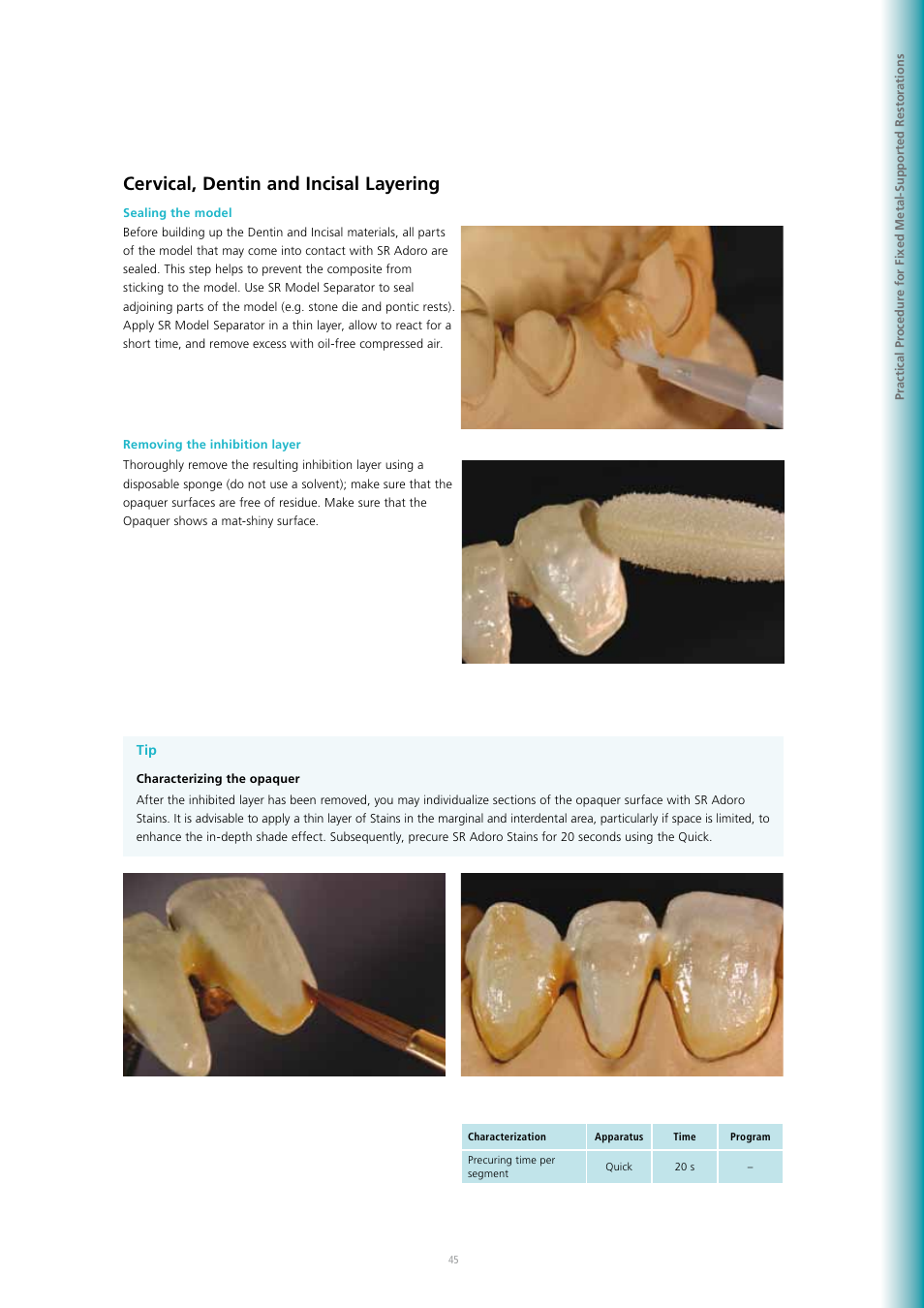 Cervical, dentin and incisal layering | Ivoclar Vivadent SR Adoro User Manual | Page 45 / 88