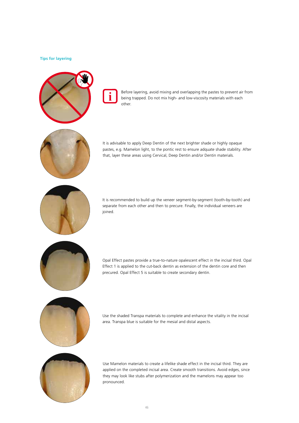 Ivoclar Vivadent SR Adoro User Manual | Page 46 / 88