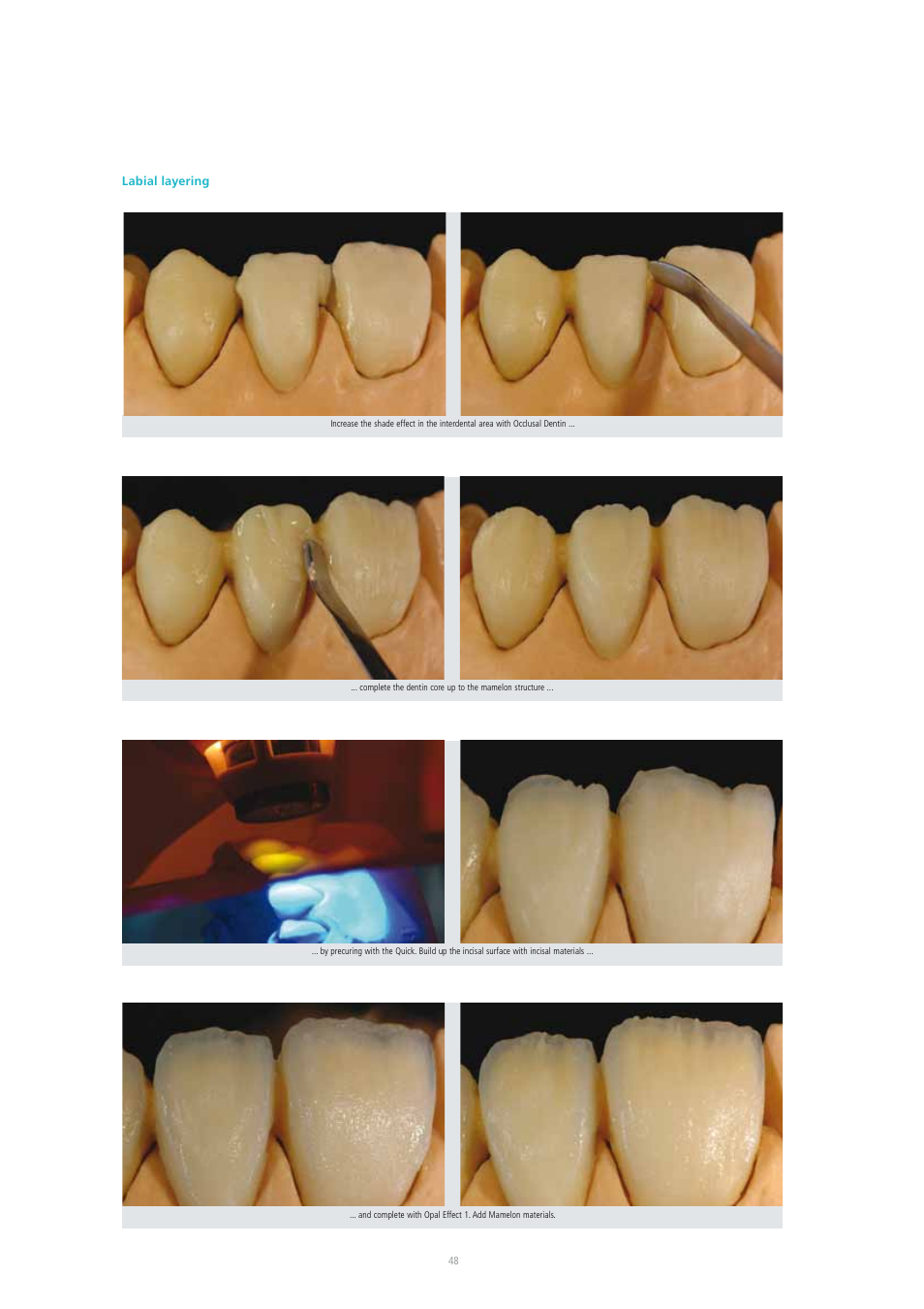 Ivoclar Vivadent SR Adoro User Manual | Page 48 / 88