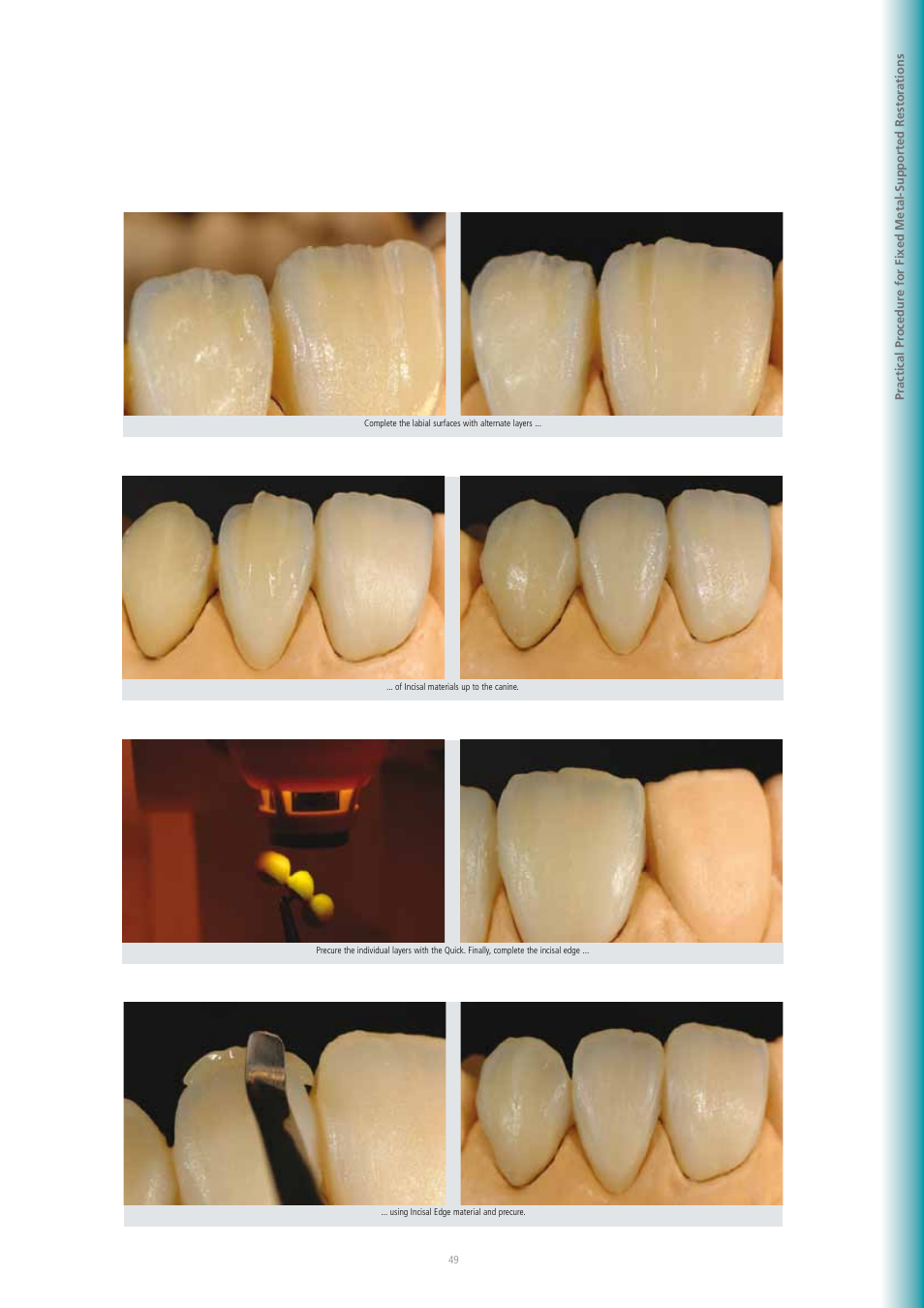 Ivoclar Vivadent SR Adoro User Manual | Page 49 / 88