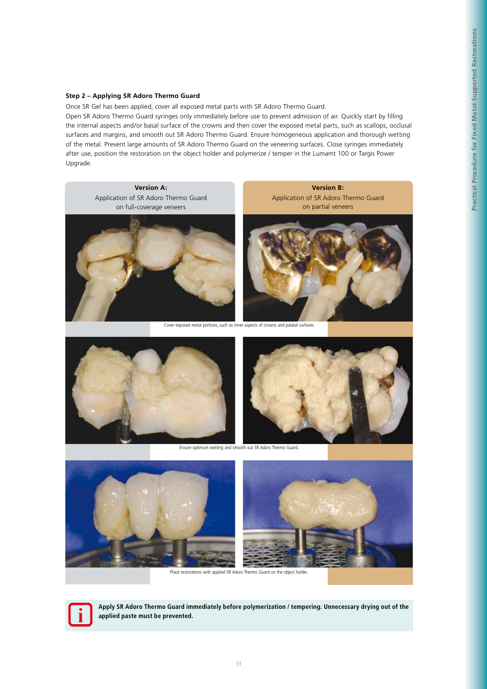 Ivoclar Vivadent SR Adoro User Manual | Page 51 / 88