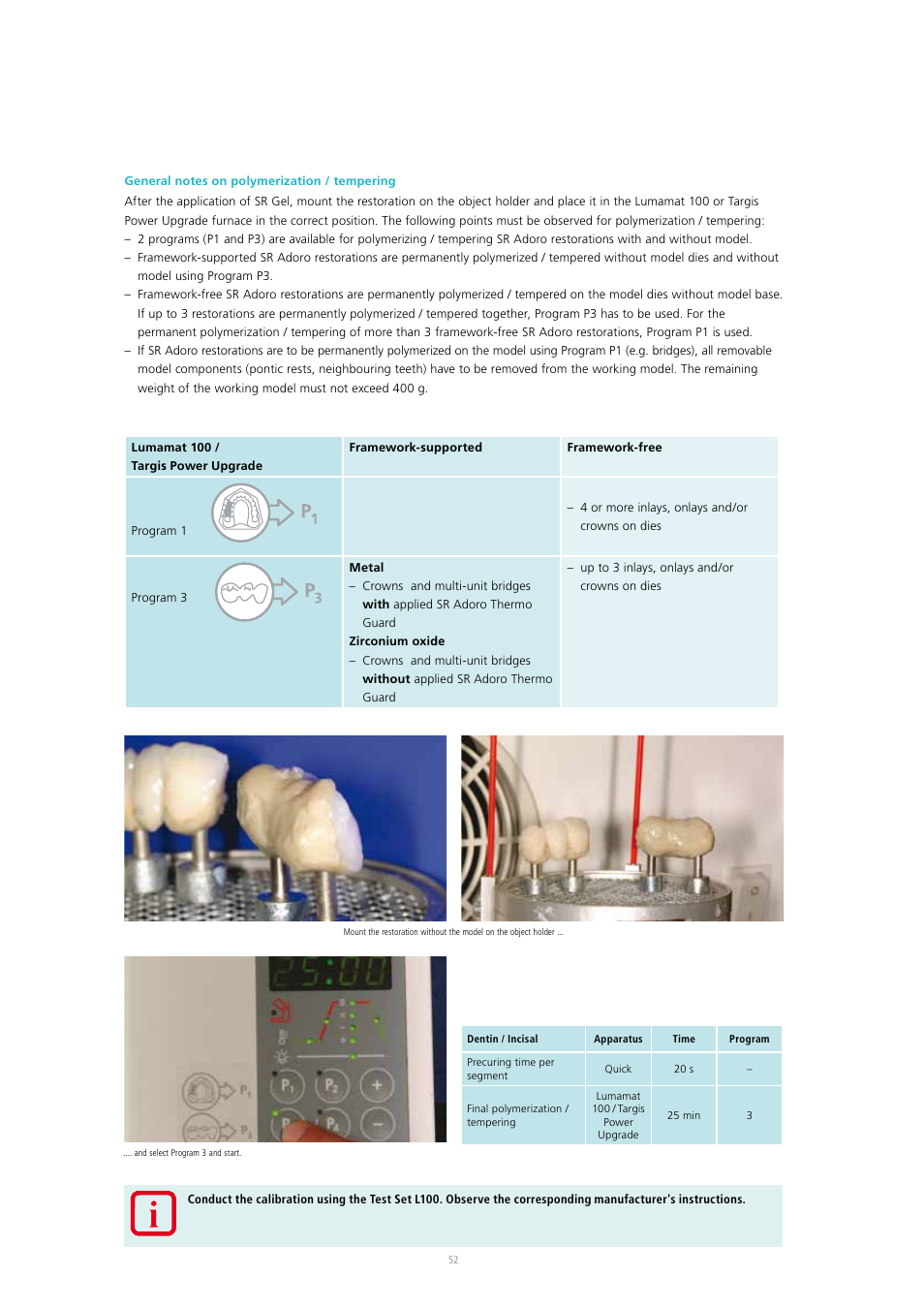 Ivoclar Vivadent SR Adoro User Manual | Page 52 / 88