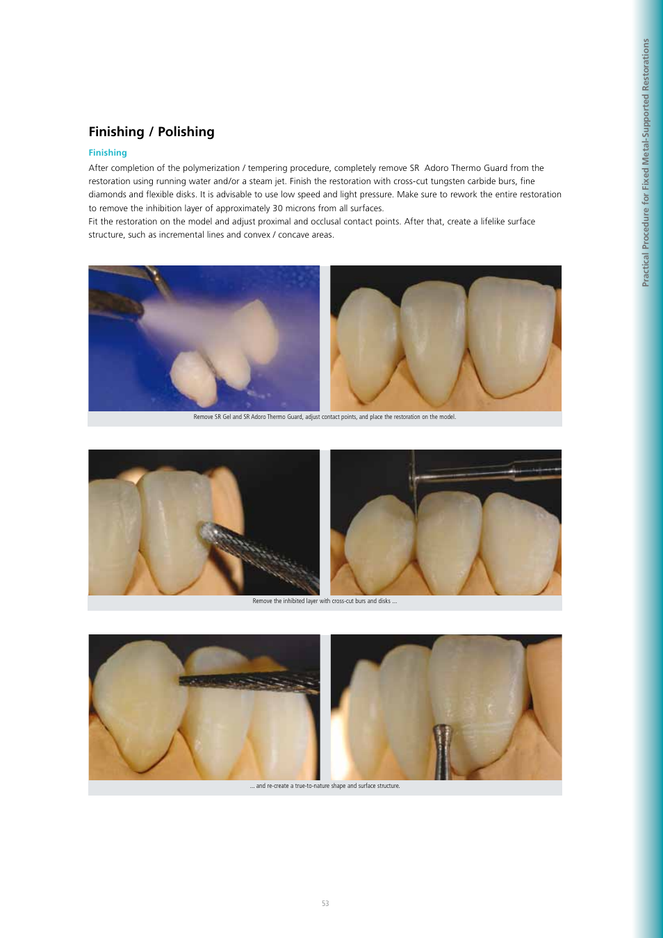 Finishing / polishing | Ivoclar Vivadent SR Adoro User Manual | Page 53 / 88