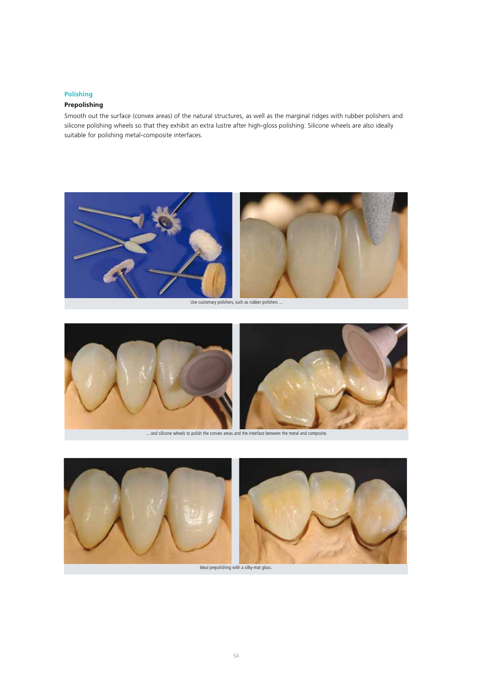 Ivoclar Vivadent SR Adoro User Manual | Page 54 / 88