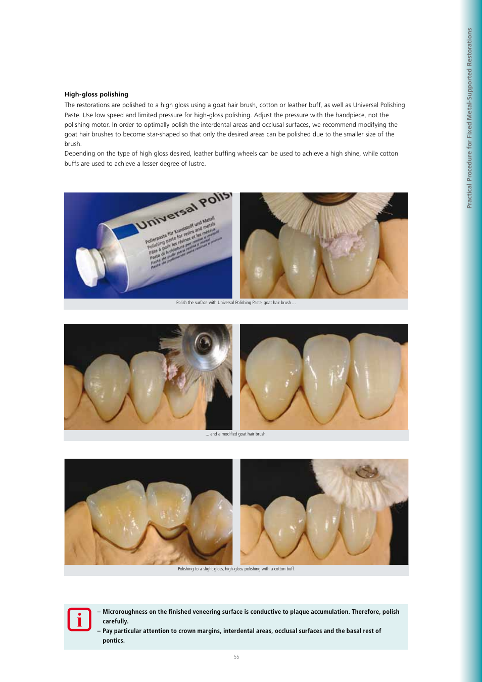 Ivoclar Vivadent SR Adoro User Manual | Page 55 / 88