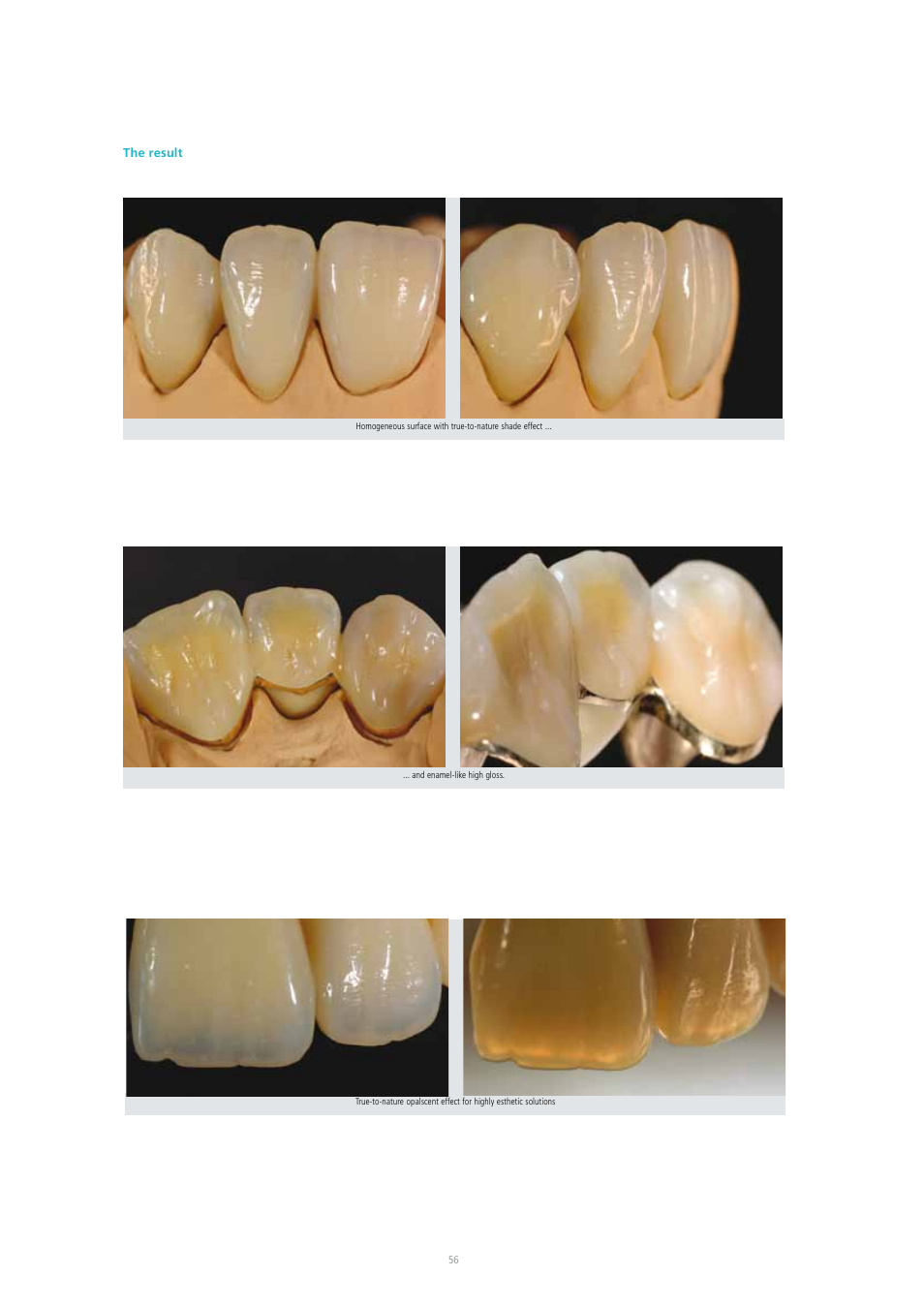 Ivoclar Vivadent SR Adoro User Manual | Page 56 / 88