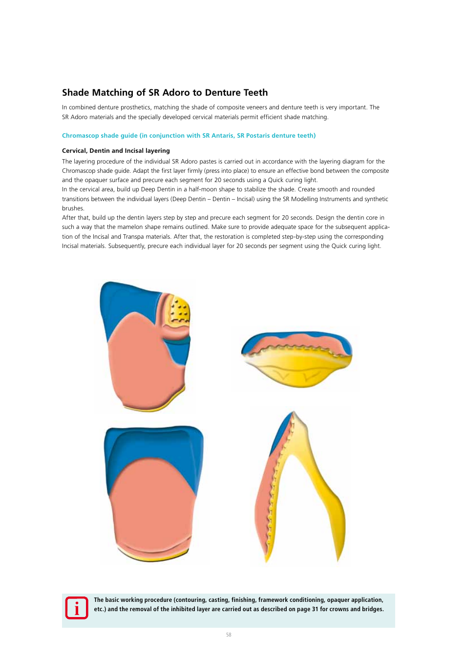 Shade matching of sr adoro to denture teeth | Ivoclar Vivadent SR Adoro User Manual | Page 58 / 88