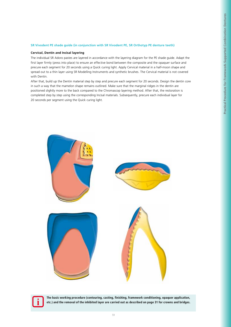 Ivoclar Vivadent SR Adoro User Manual | Page 59 / 88