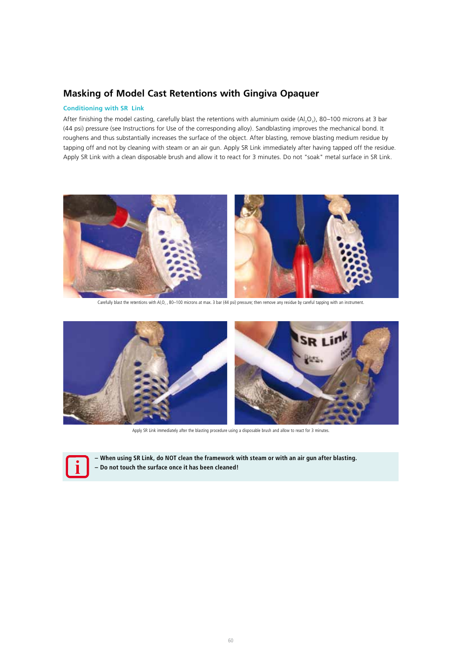 Ivoclar Vivadent SR Adoro User Manual | Page 60 / 88