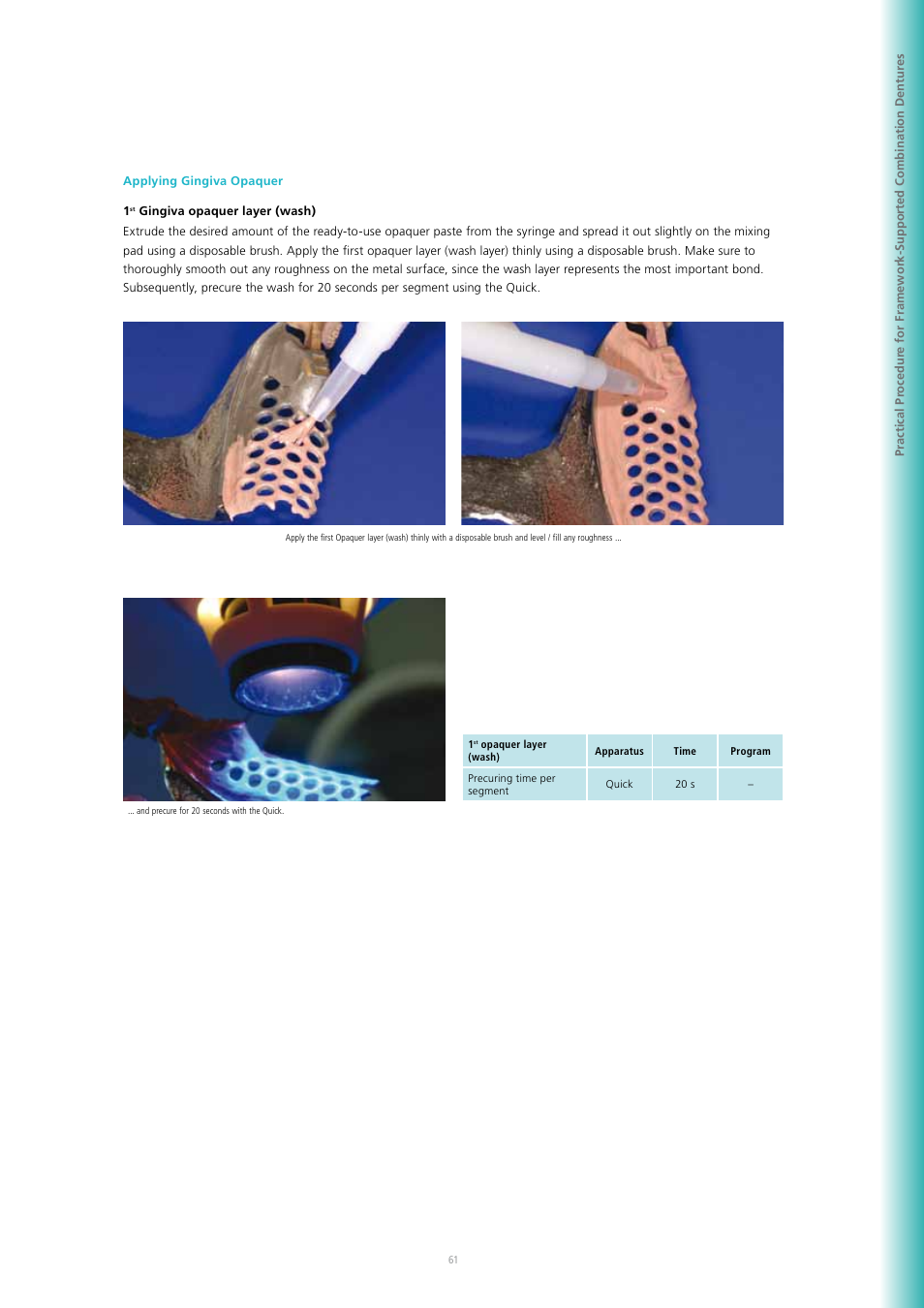 Ivoclar Vivadent SR Adoro User Manual | Page 61 / 88