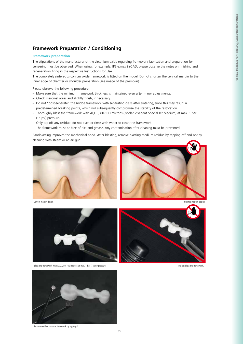 Framework preparation / conditioning | Ivoclar Vivadent SR Adoro User Manual | Page 65 / 88