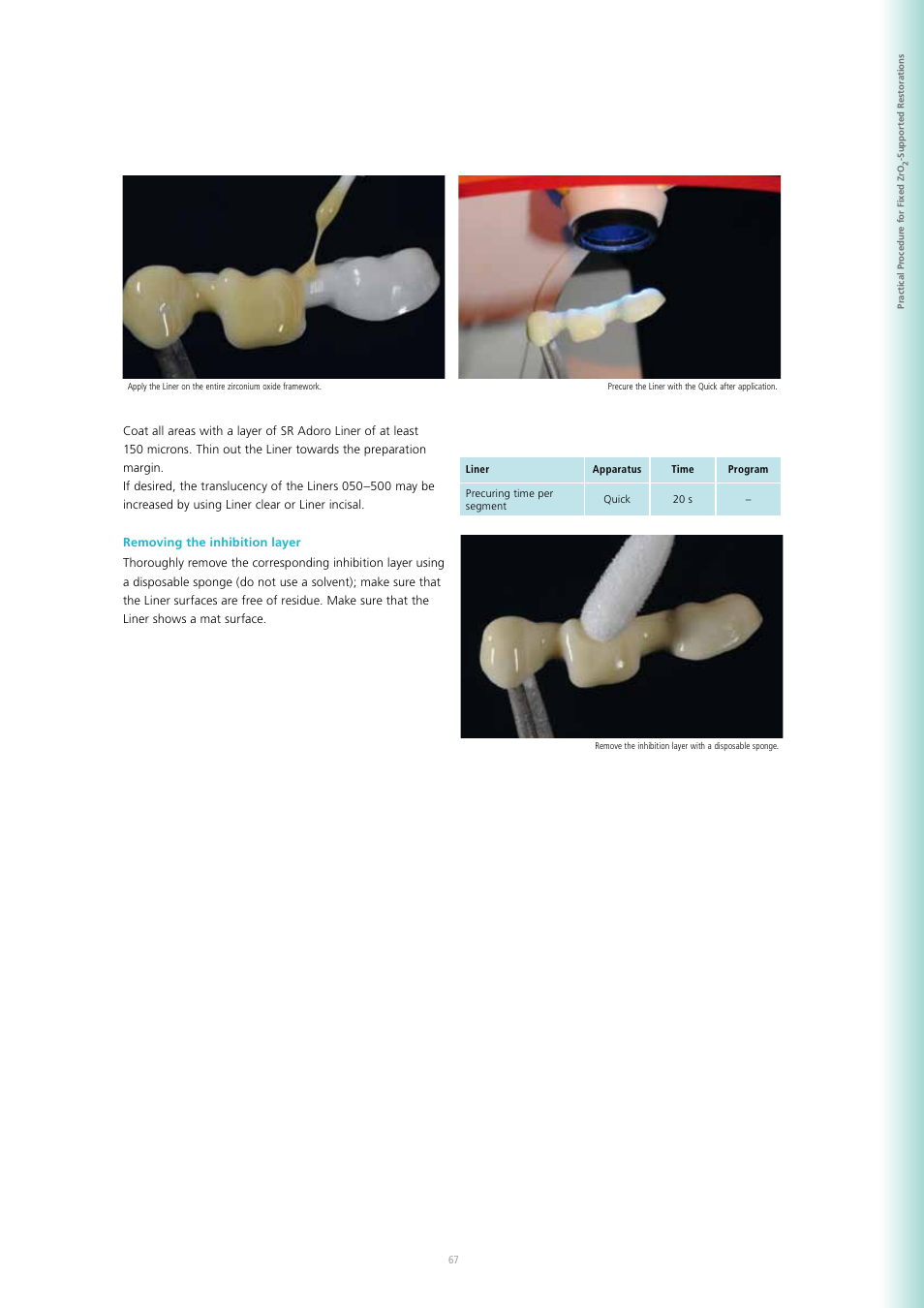 Ivoclar Vivadent SR Adoro User Manual | Page 67 / 88