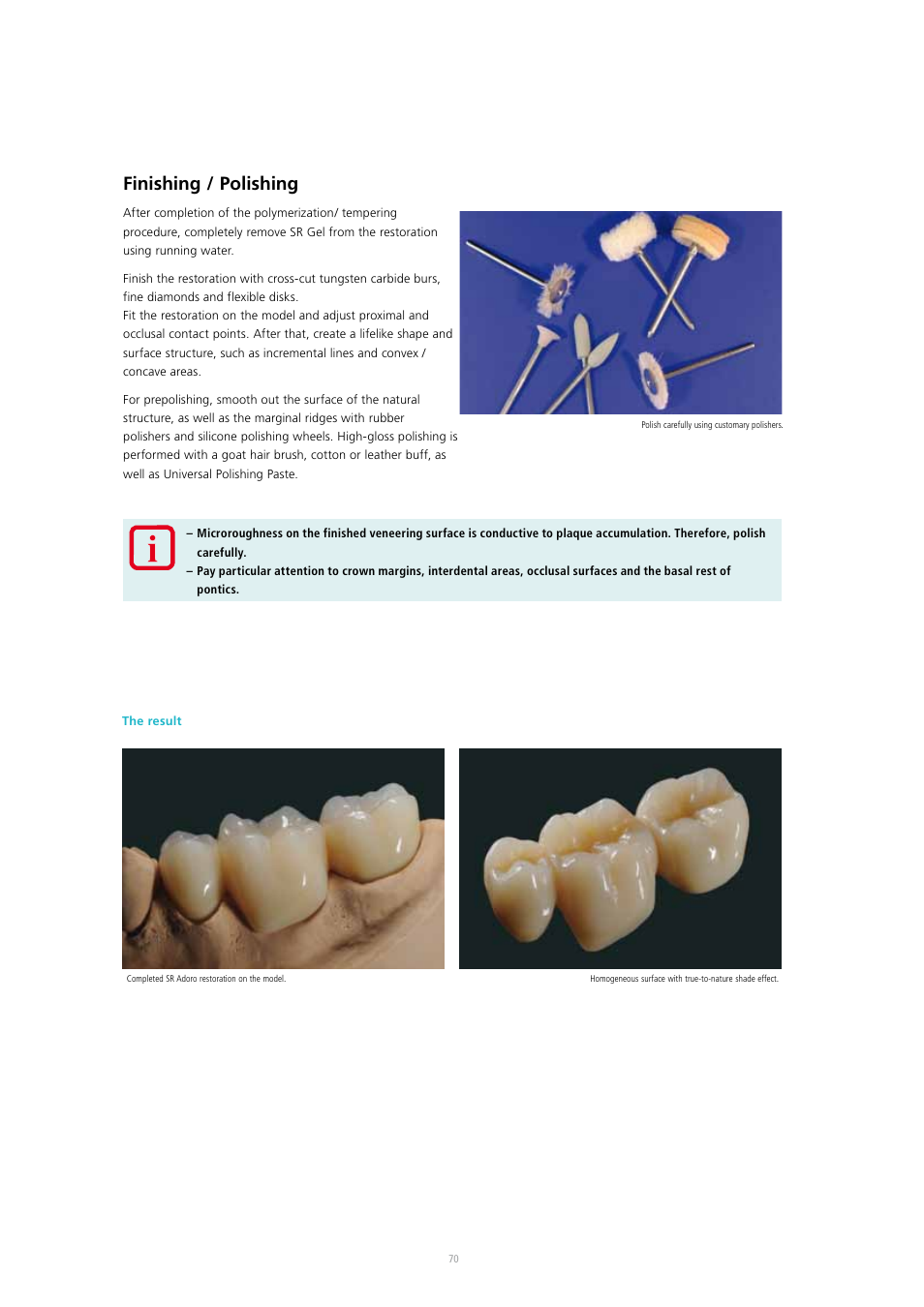 Finishing / polishing | Ivoclar Vivadent SR Adoro User Manual | Page 70 / 88