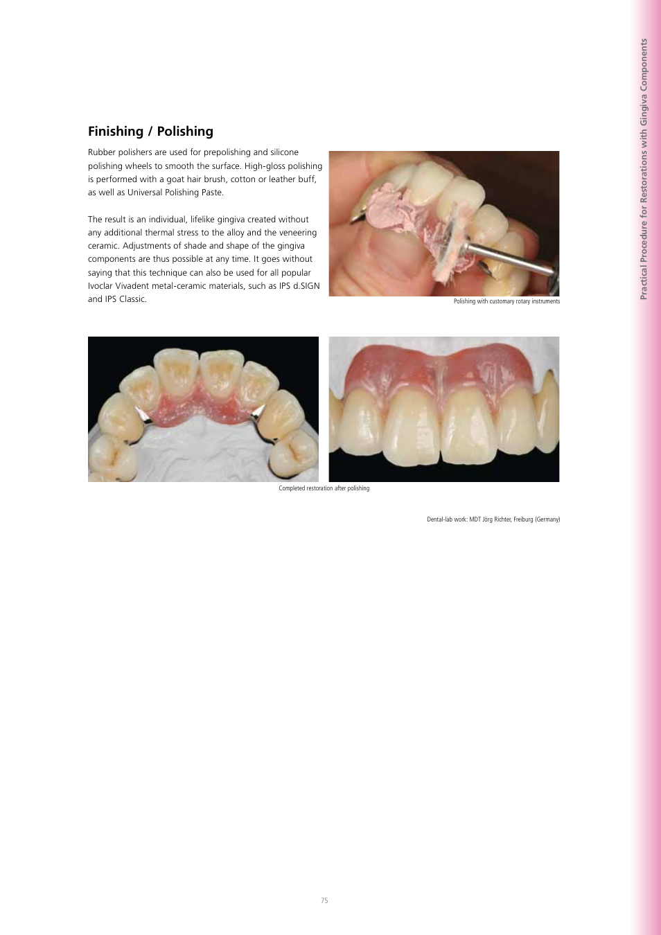 Finishing / polishing | Ivoclar Vivadent SR Adoro User Manual | Page 75 / 88