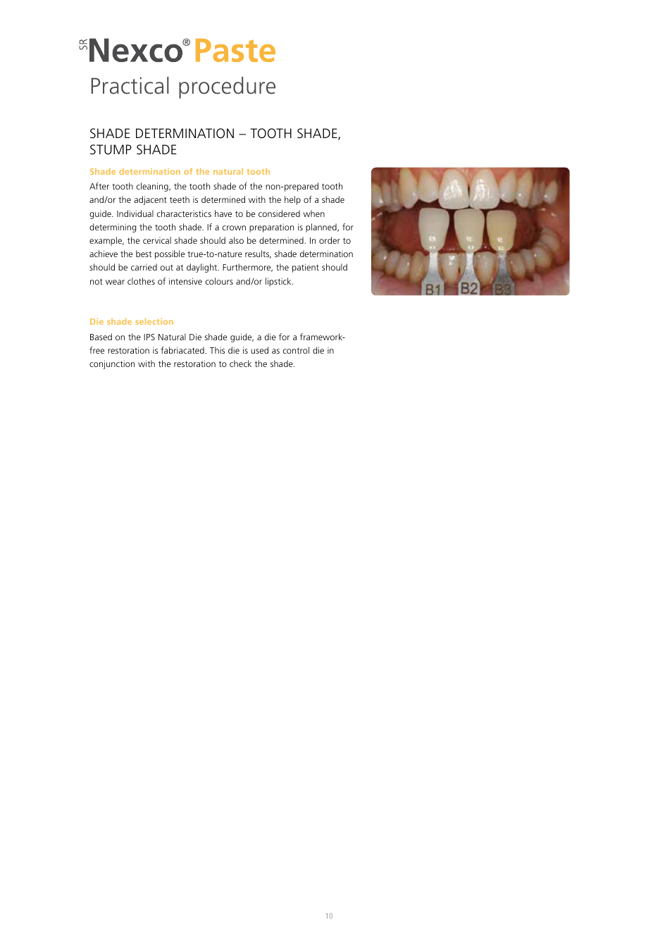 Practical procedure | Ivoclar Vivadent SR Nexco Paste User Manual | Page 10 / 64