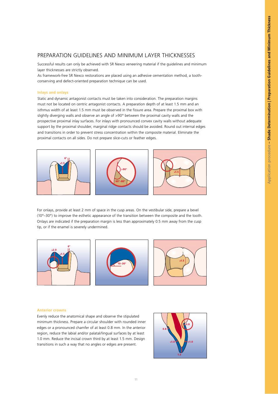 Ivoclar Vivadent SR Nexco Paste User Manual | Page 11 / 64