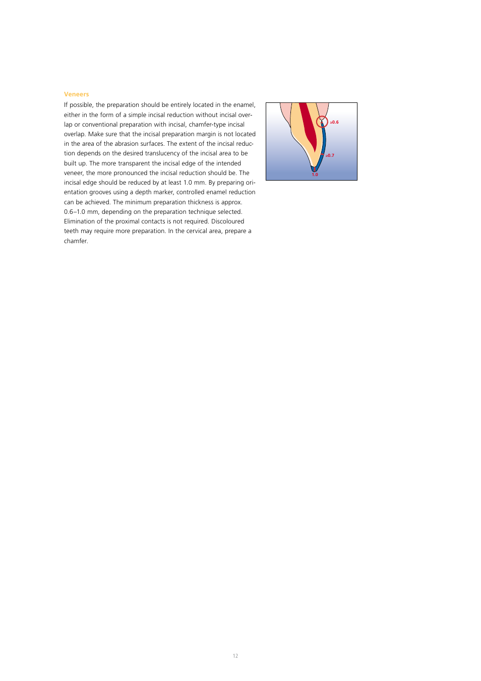 Ivoclar Vivadent SR Nexco Paste User Manual | Page 12 / 64