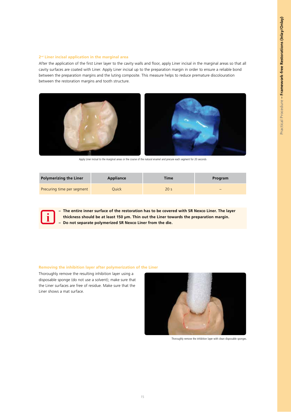 Ivoclar Vivadent SR Nexco Paste User Manual | Page 15 / 64