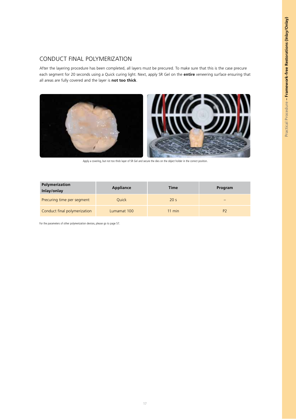 Conduct final polymerization | Ivoclar Vivadent SR Nexco Paste User Manual | Page 17 / 64