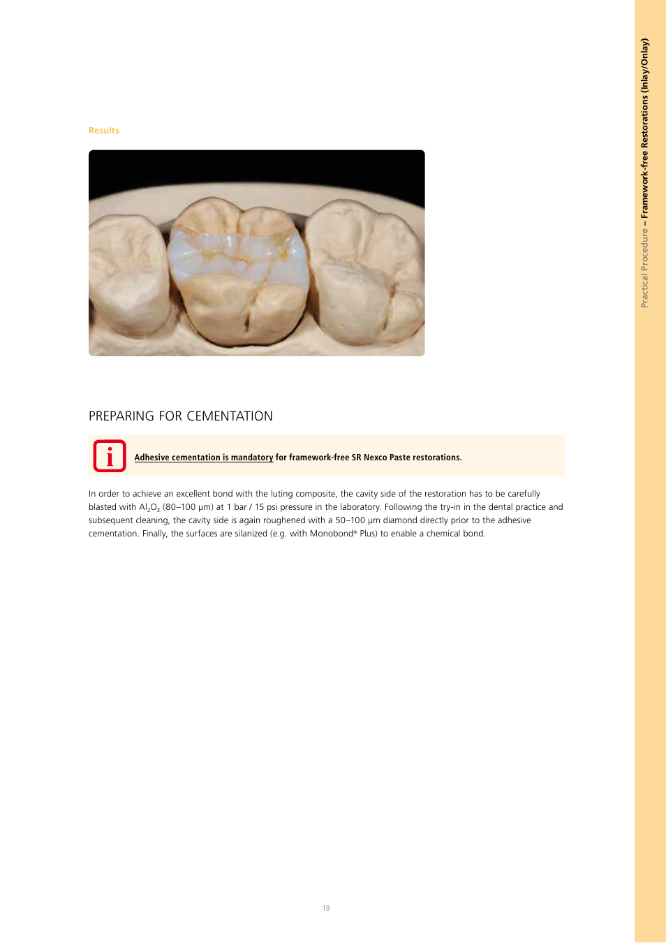 Preparing for cementation | Ivoclar Vivadent SR Nexco Paste User Manual | Page 19 / 64