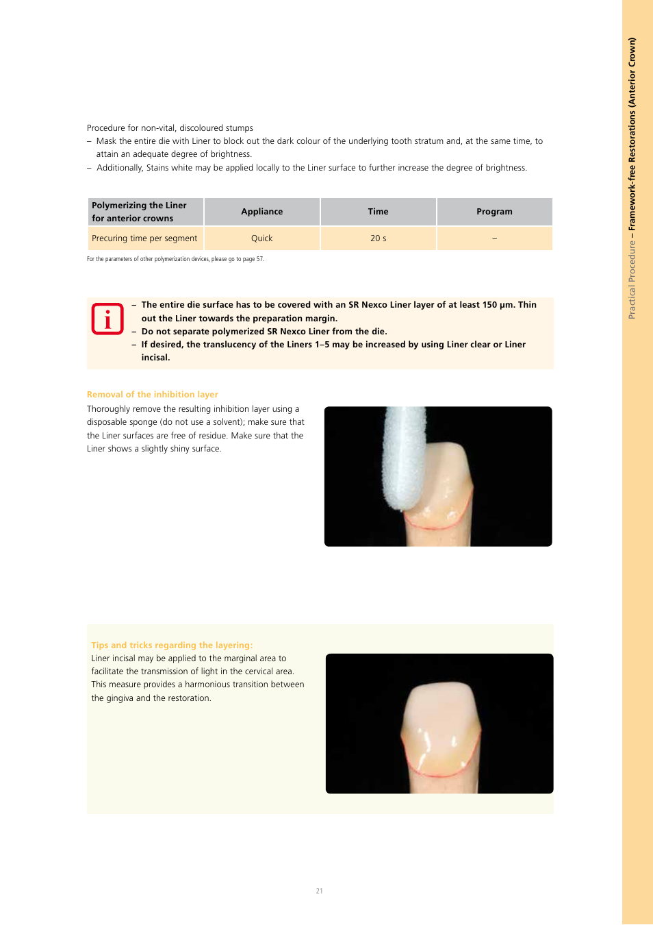 Ivoclar Vivadent SR Nexco Paste User Manual | Page 21 / 64