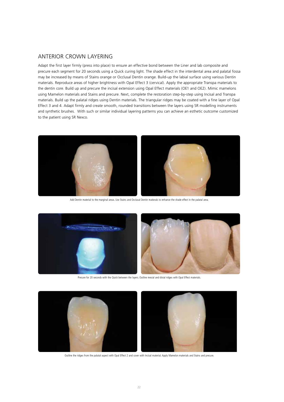 Anterior crown layering | Ivoclar Vivadent SR Nexco Paste User Manual | Page 22 / 64