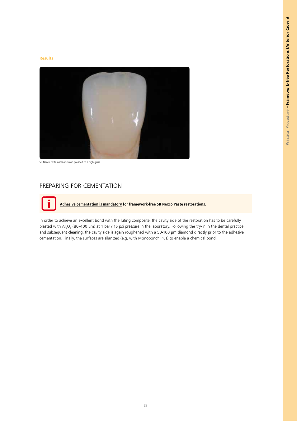 Preparing for cementation | Ivoclar Vivadent SR Nexco Paste User Manual | Page 25 / 64