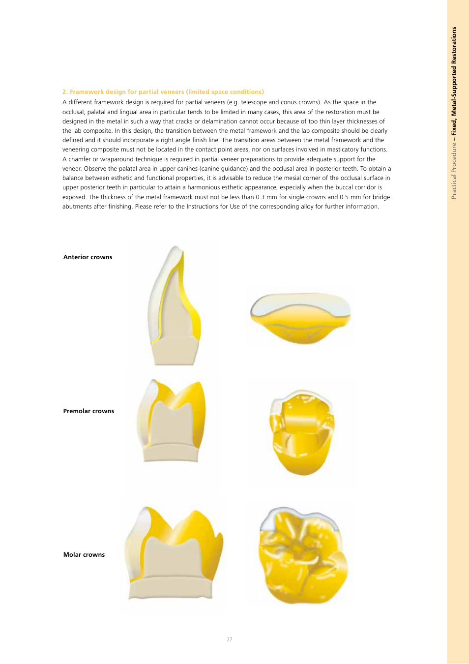 Ivoclar Vivadent SR Nexco Paste User Manual | Page 27 / 64