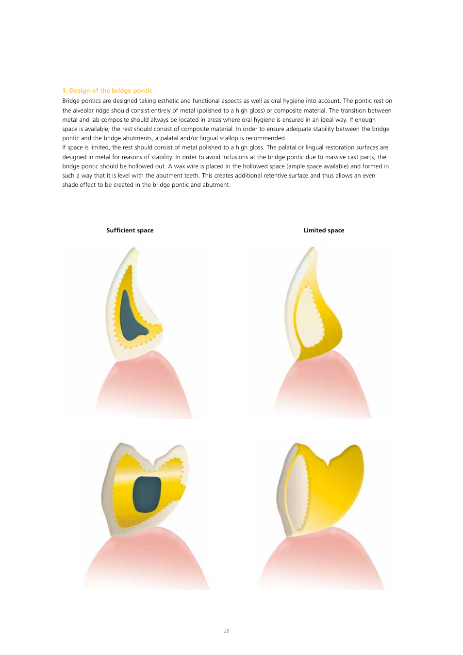 Ivoclar Vivadent SR Nexco Paste User Manual | Page 28 / 64