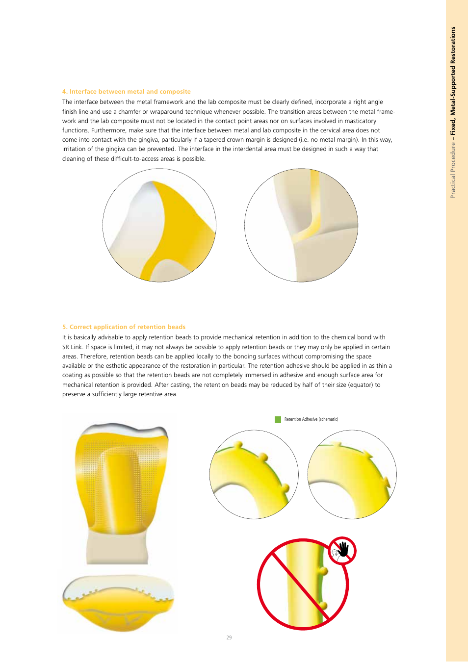 Ivoclar Vivadent SR Nexco Paste User Manual | Page 29 / 64