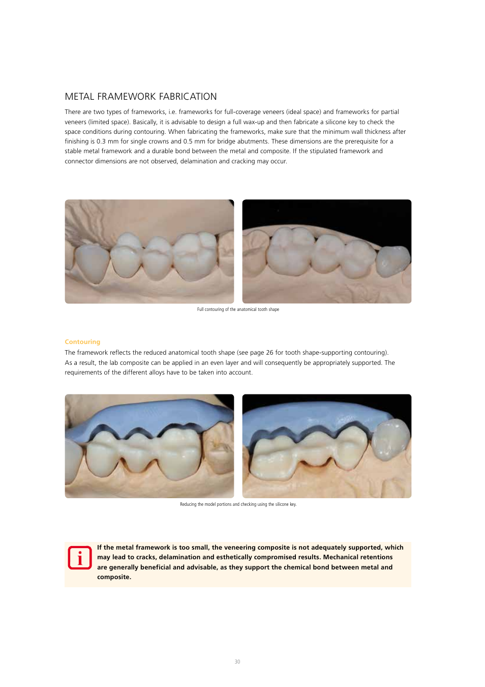 Metal framework fabrication | Ivoclar Vivadent SR Nexco Paste User Manual | Page 30 / 64