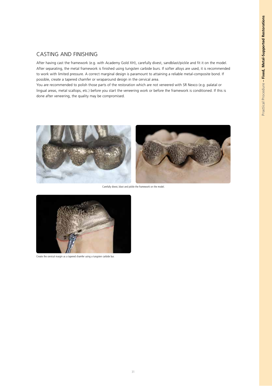 Casting and finishing | Ivoclar Vivadent SR Nexco Paste User Manual | Page 31 / 64