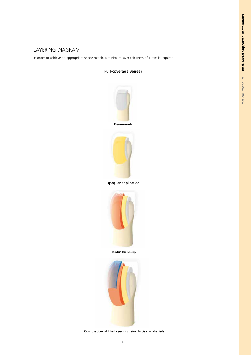 Layering diagram | Ivoclar Vivadent SR Nexco Paste User Manual | Page 33 / 64