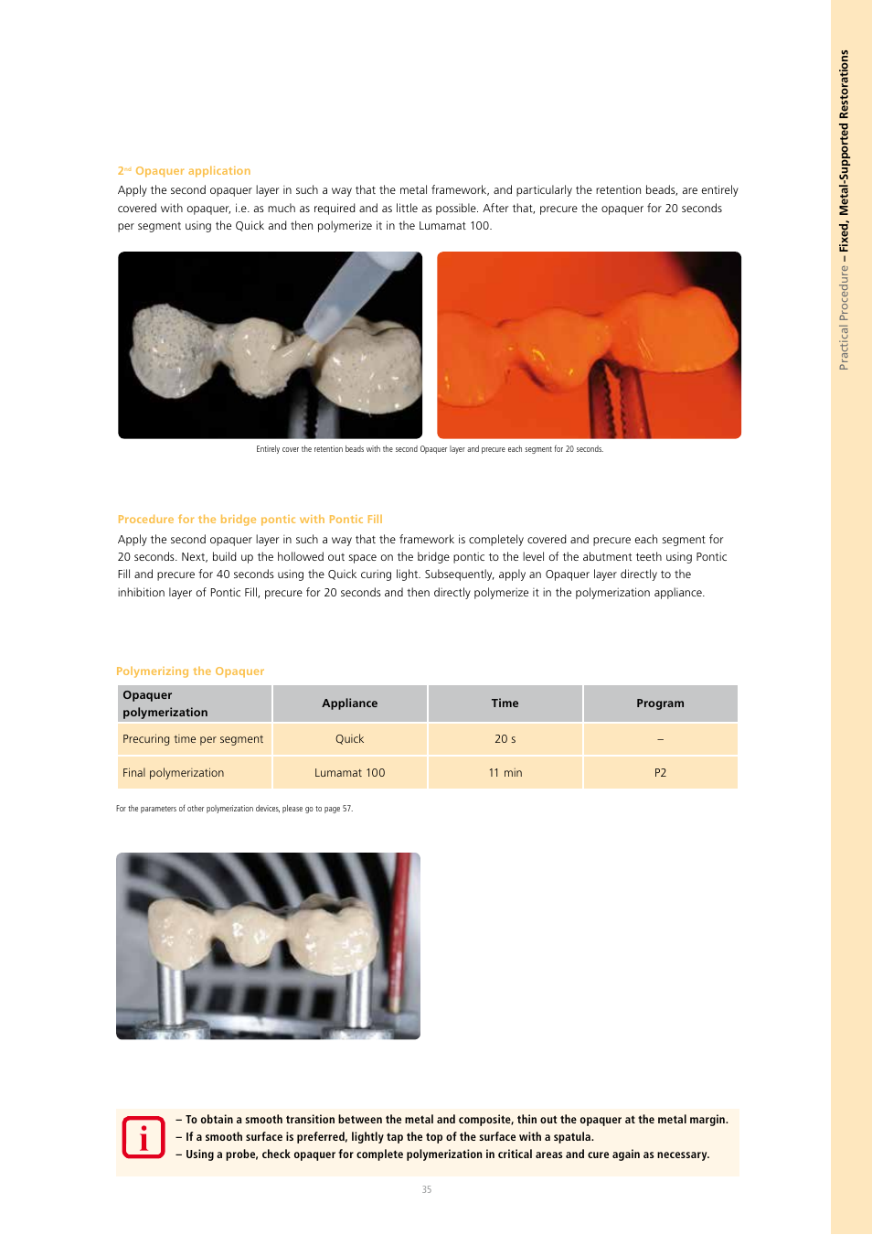 Ivoclar Vivadent SR Nexco Paste User Manual | Page 35 / 64