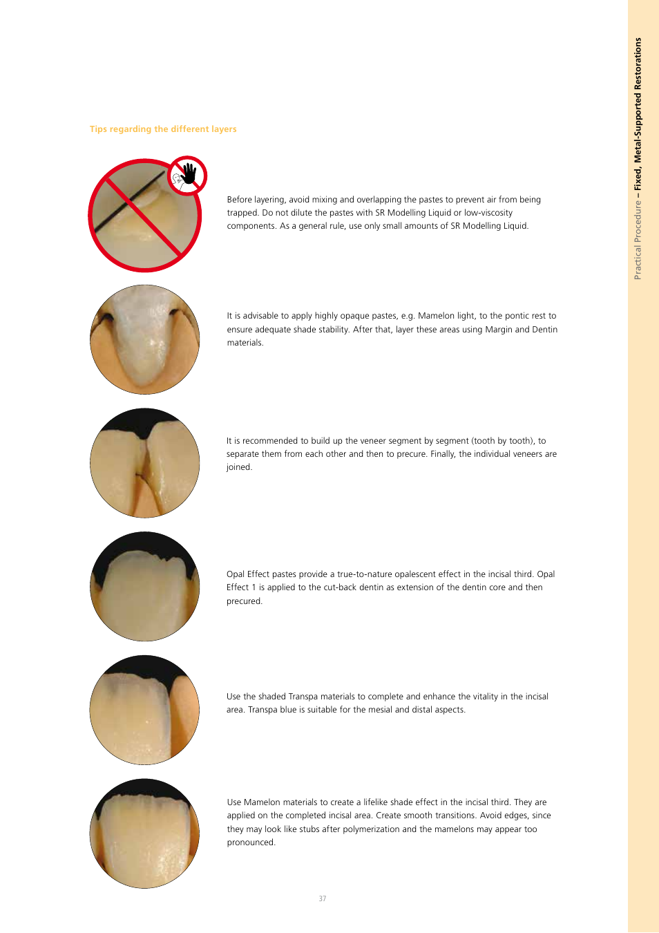Ivoclar Vivadent SR Nexco Paste User Manual | Page 37 / 64