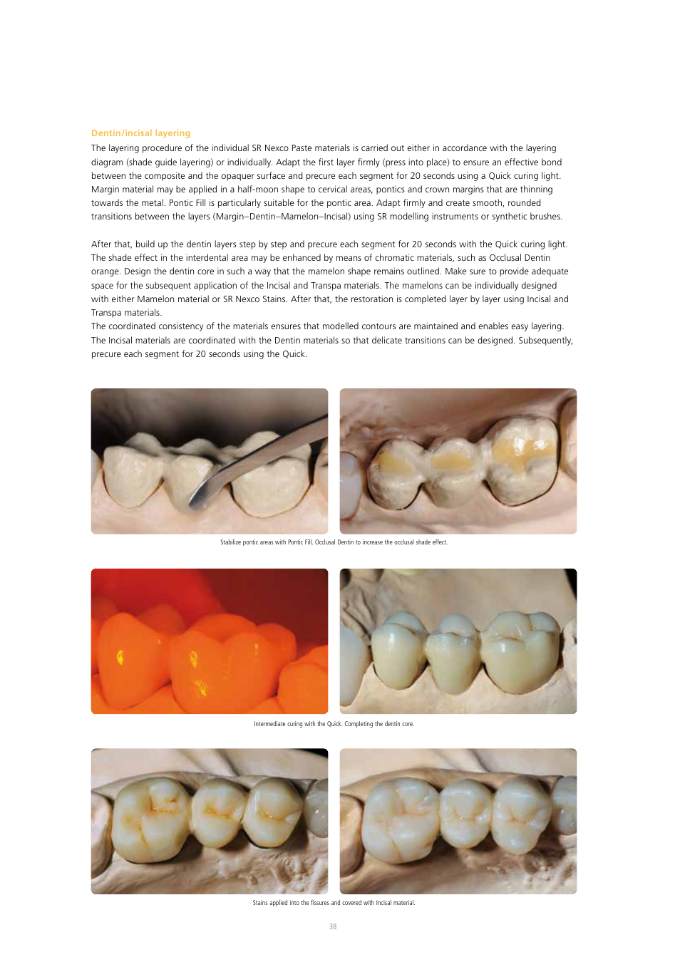 Ivoclar Vivadent SR Nexco Paste User Manual | Page 38 / 64