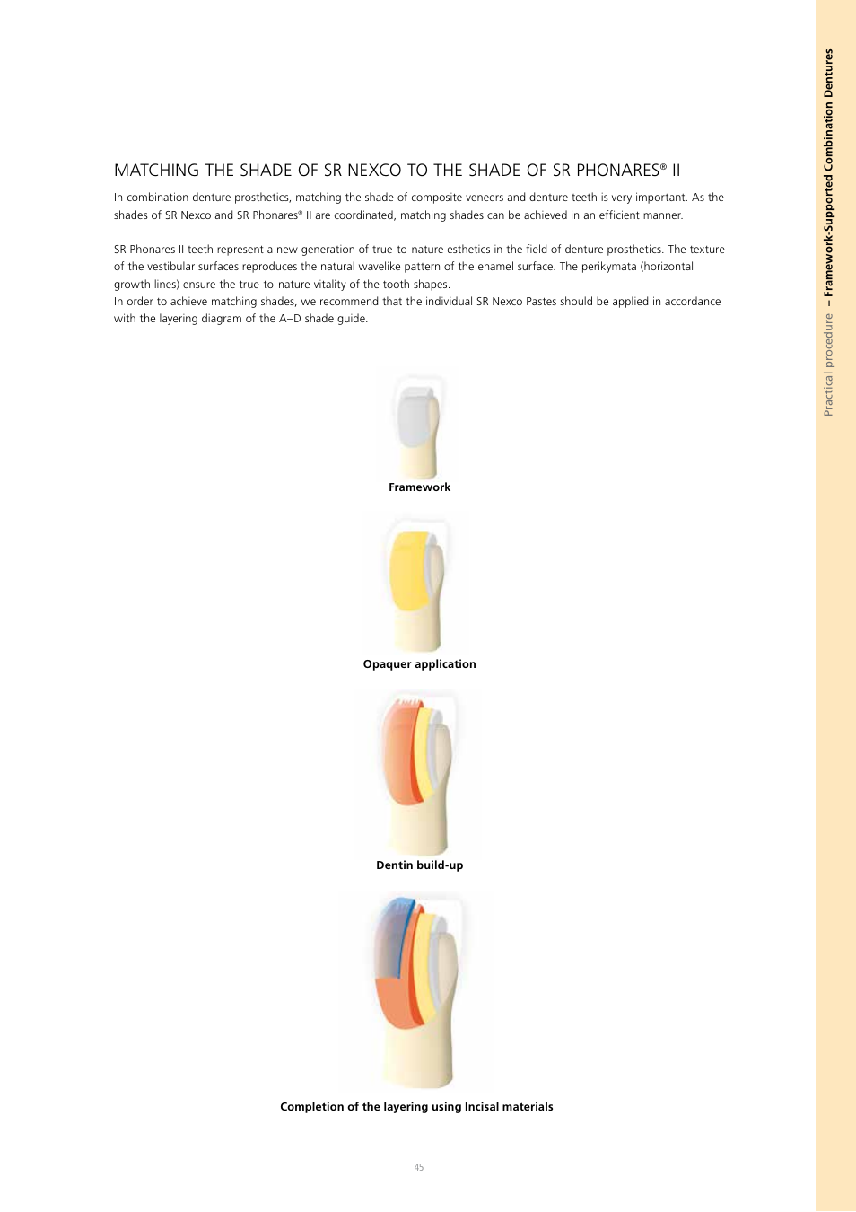 Ivoclar Vivadent SR Nexco Paste User Manual | Page 45 / 64