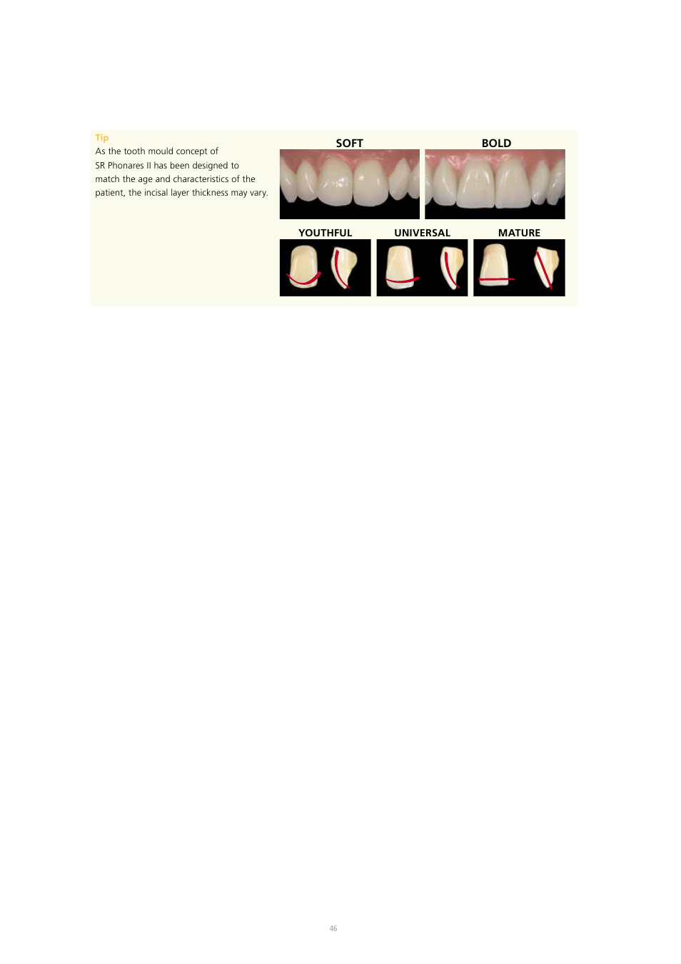 Ivoclar Vivadent SR Nexco Paste User Manual | Page 46 / 64